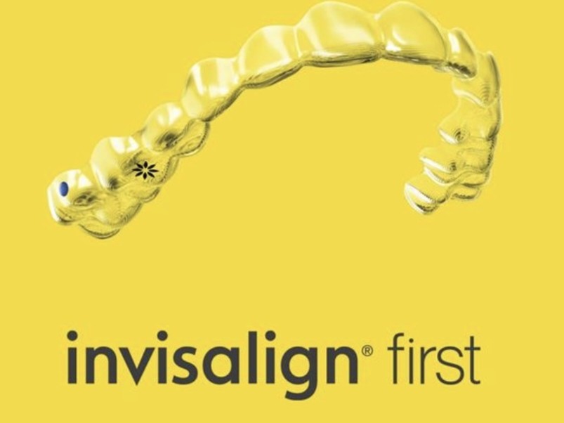 Invisalign First clear aligner tray for growing children